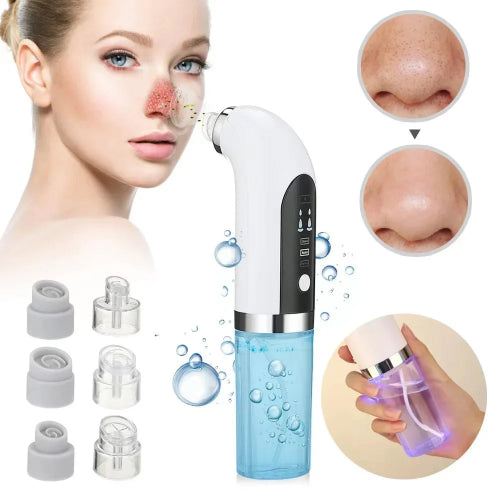 Effective tool for removing blackheads