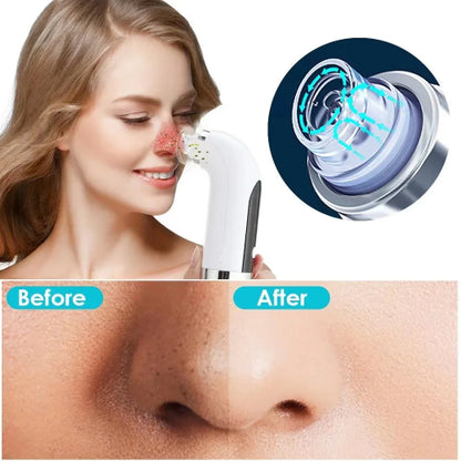 Powered solution for deep pore cleansing