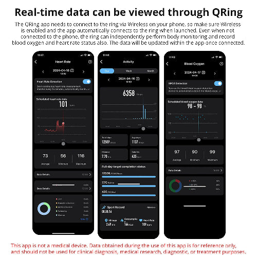 View data through Qring